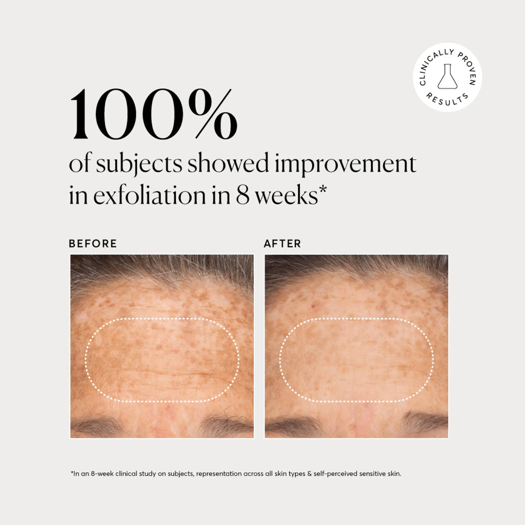bha-liquid-exfoliant-2-s7 NATR-10027-Alt-Images-BHA-Liquid-Exfoliant-2_-03.webp