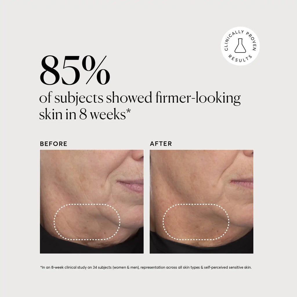 retinol-complex-serum-z2 NATR-10034-Alt-Images-Retinol-Complex-Serum-04.webp
