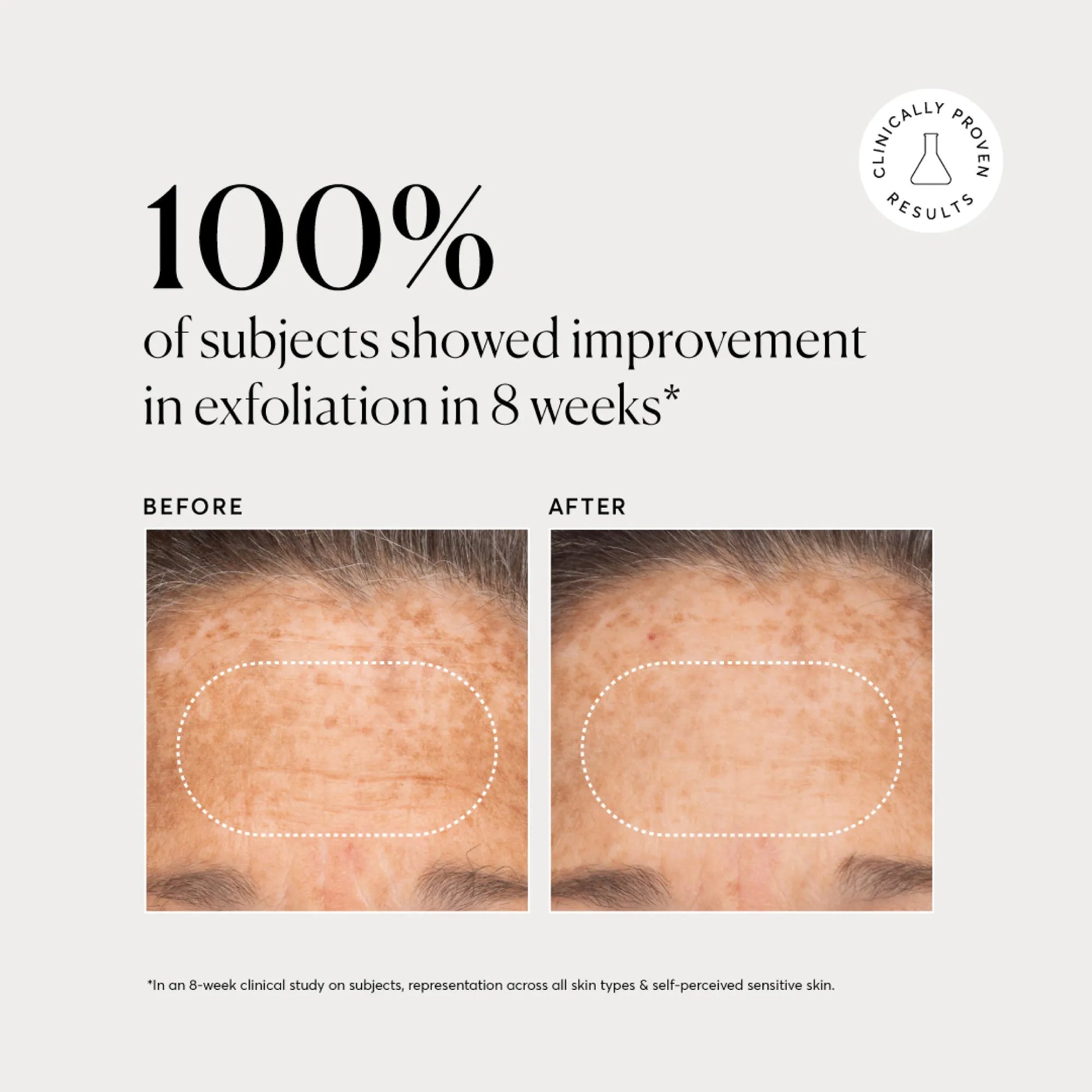 bha-liquid-exfoliant-2-s7 NATR-10027-Alt-Images-BHA-Liquid-Exfoliant-2_-03.webp